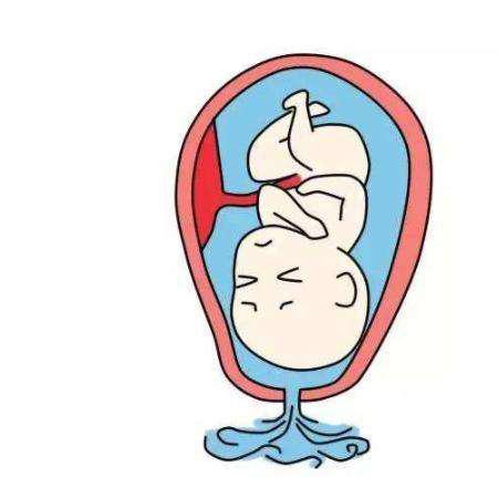 肚子不痛就是拉水怎么回事,肚子不痛破水