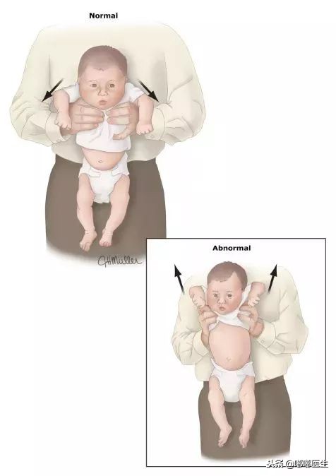 宝宝爱攥拳头是怎么回事,宝宝双臂向后使劲是肌张力高么