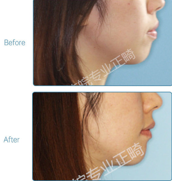 杭州口腔医院整牙,杭州整牙医生怎么选