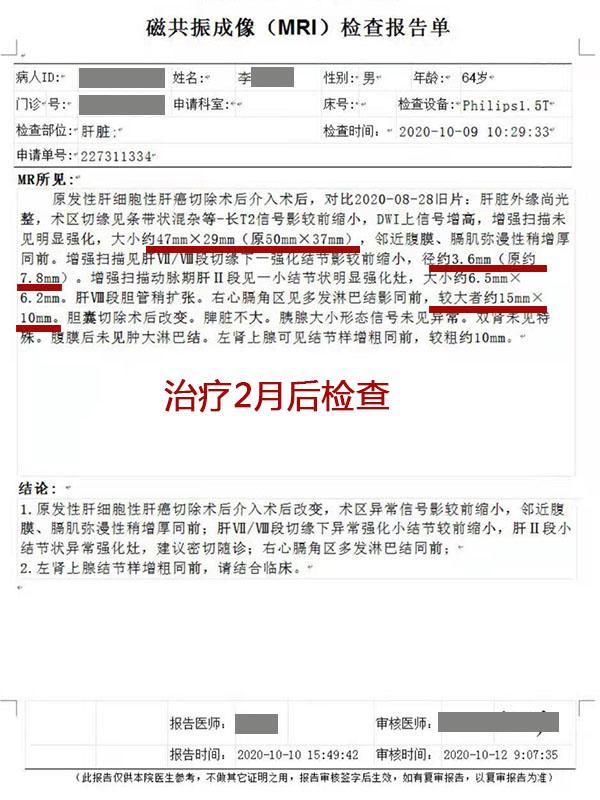 肝癌复发切除后治愈,肝癌复发骨转移