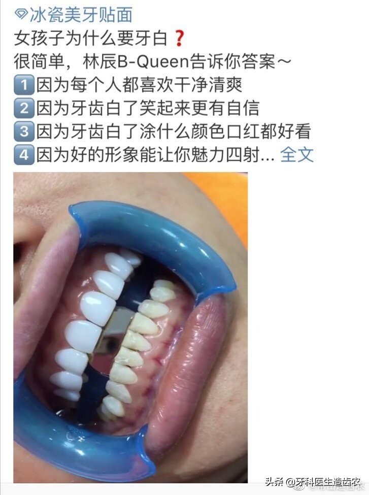 美牙师技术培训,美牙师学习