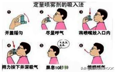 哮喘患者如何正确使用吸入剂,哮喘用吸入剂还是孟鲁司特