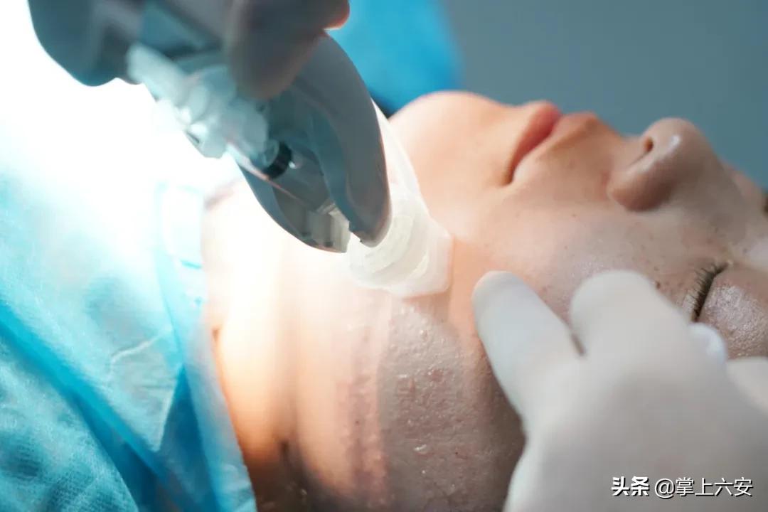 打水光针后悔了,千万不要打水光针太可怕了