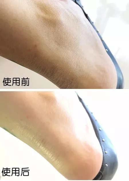 蔡依林的腿值多少钱,蔡依林最迷人的鞋