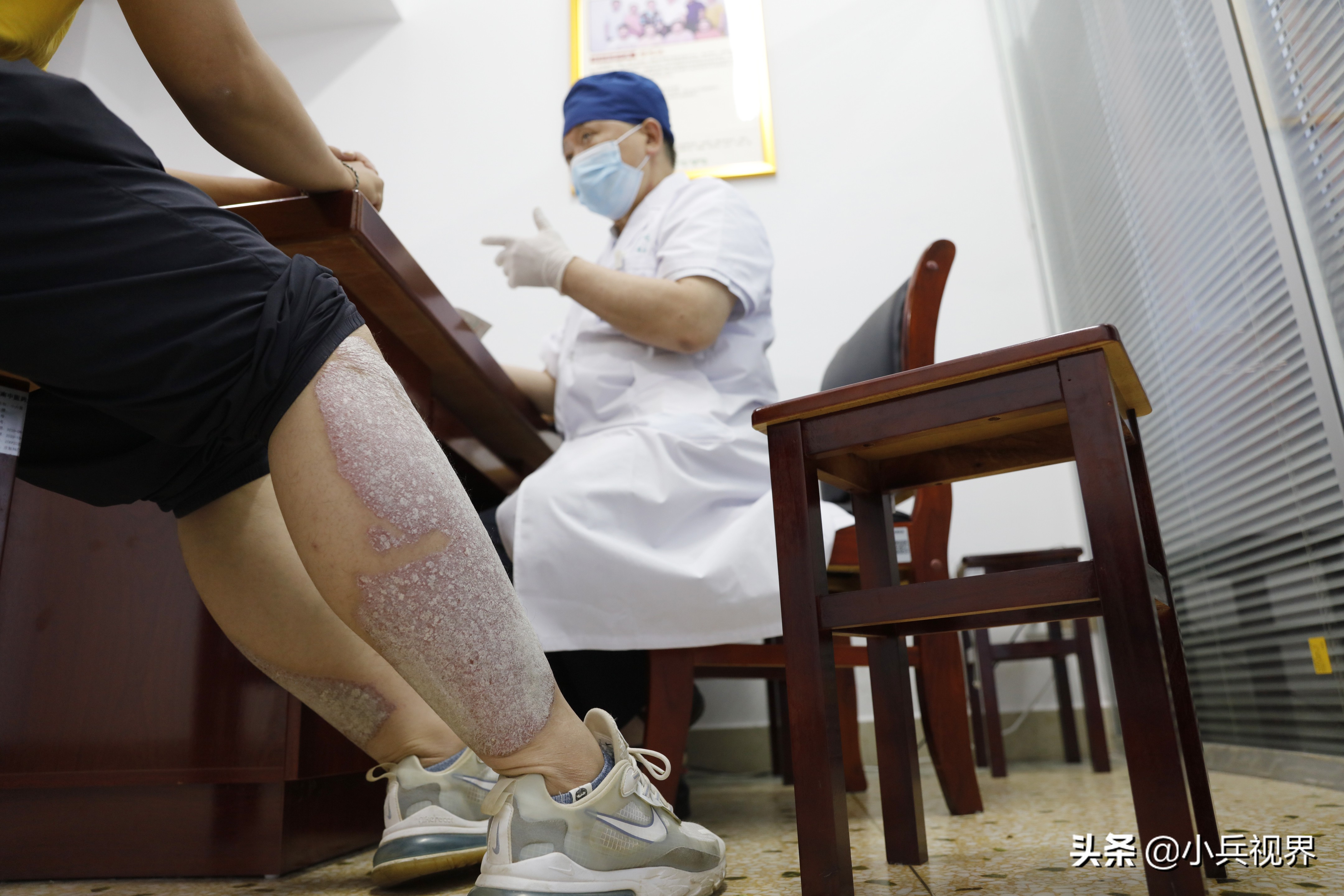 治皮肤病千年古方,皮肤病老中医行医多年