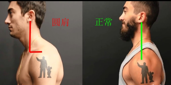 溜肩是斜方肌紧张嘛,如何改善肩胛骨和斜方肌