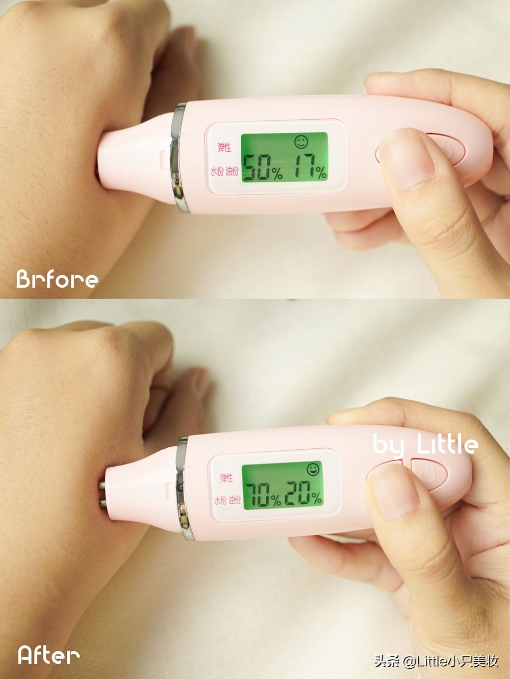 拯救小秘密,拯救毛孔粗大黑头粉刺