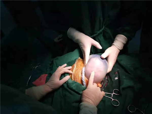 36周产下男婴肚子里还有哪吒,哪吒怀孕42周