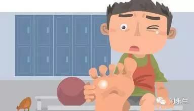 鸡眼掉了会残留吗,鸡眼处理方法推荐