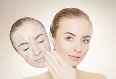 脸上有刺痒感是怎么回事,脸部皮肤刺痒怎么回事