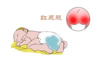 宝宝纸尿裤什么时候可以不用,婴儿用纸尿裤需要注意什么