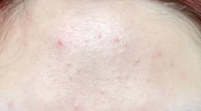 医美用的护肤品修护,医美用的化妆品