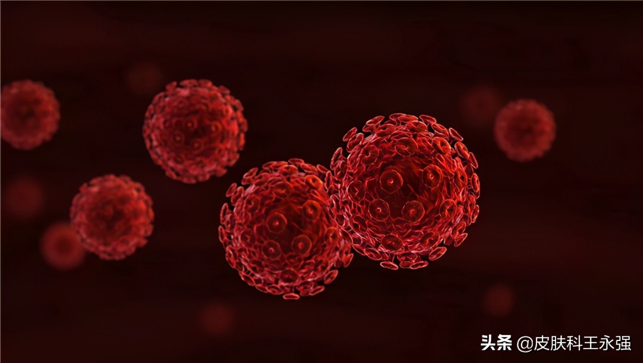 艾滋病患者，前期会有哪些表现？怎样正确的预防，医生一步步教你