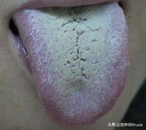 舌头观察身体症状,舌头观察健康状况