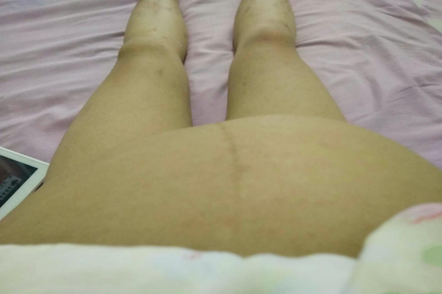 孕期肚子一边高,孕期肚子一边高一边低是臀位吗