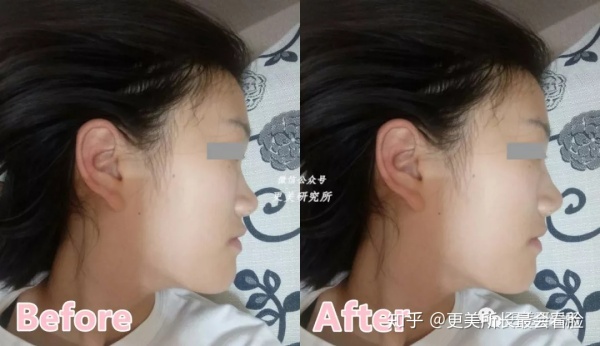 好看的侧脸要符合哪些条件,好看的侧脸的标准