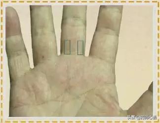 手上的健康秘密,手的颜色能看出健康的问题吗