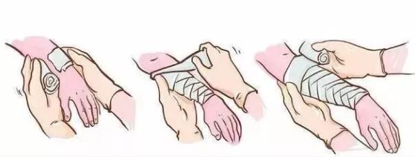 外伤引起的白癜风早期症状,白癜风有外伤一定会同形反应吗