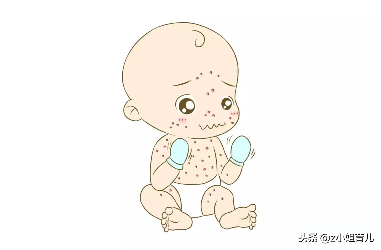 宝宝皮肤冻伤怎么办,宝宝冻疮破皮怎么尽快好