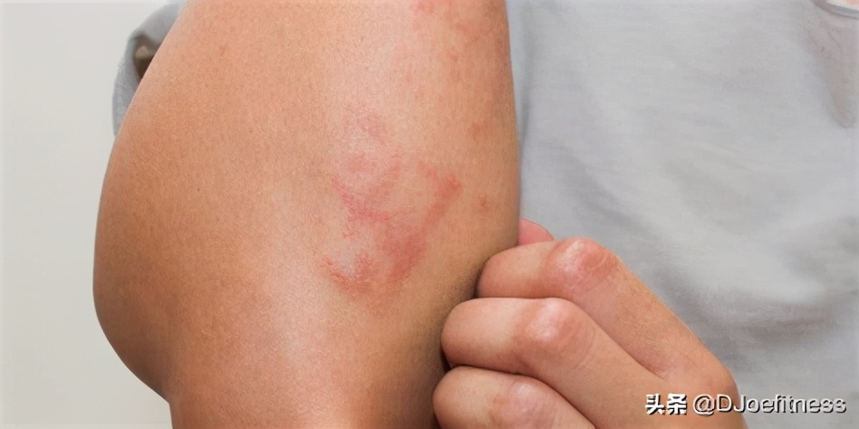 减肥后人变黑了怎么办,减肥后人变憔悴没精神