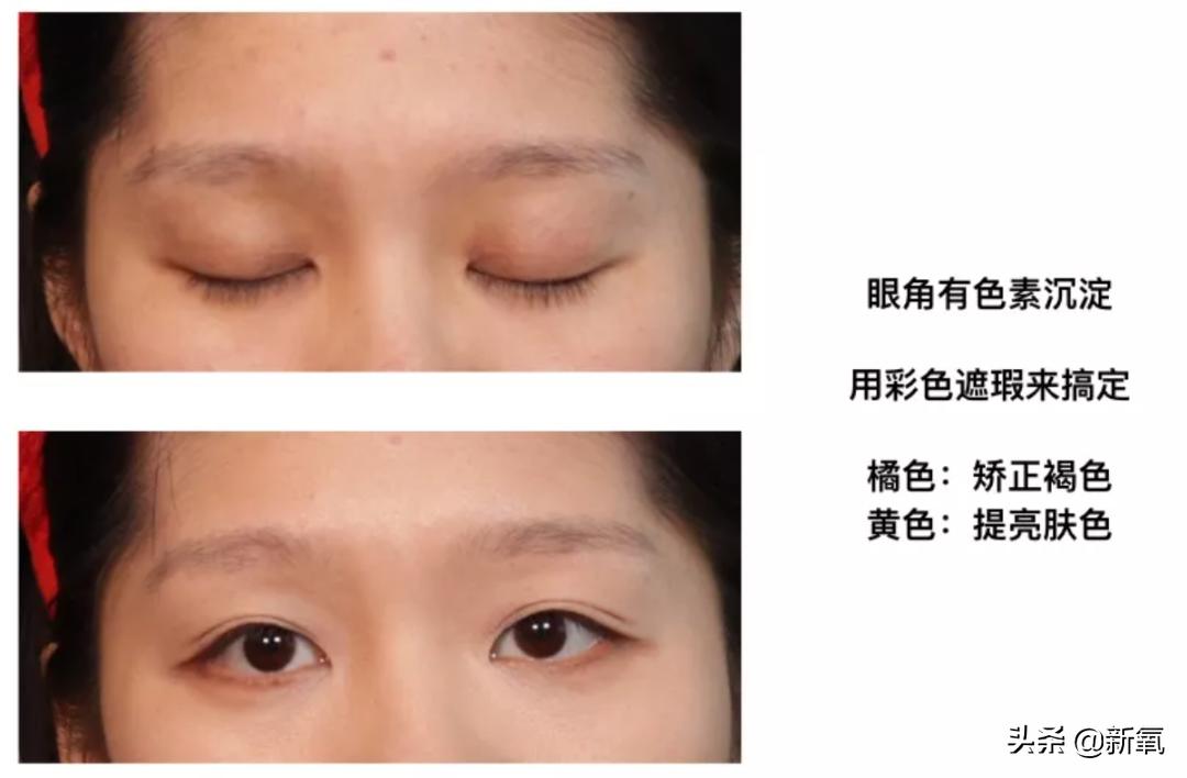 村姑整成鞠婧祎的鼻子变天使,鞠婧祎的鼻子整过吗