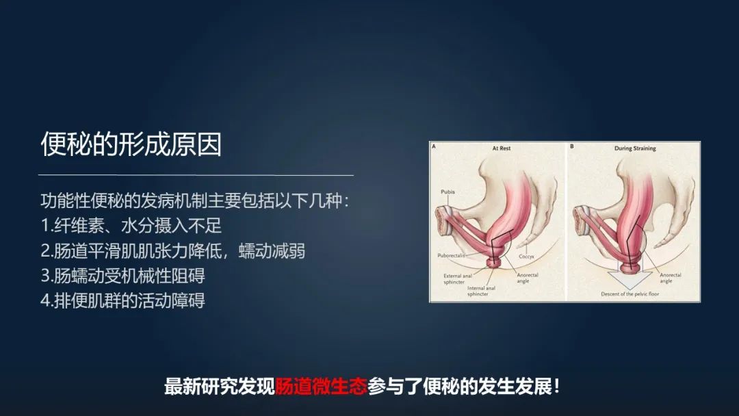 一招调理肠道改善便秘,肠道水疗治便秘有效吗