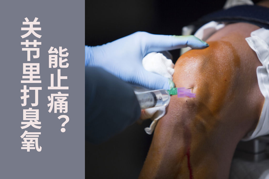 打臭氧针治关节炎有副作用吗,关节疼痛可以用臭氧注射吗