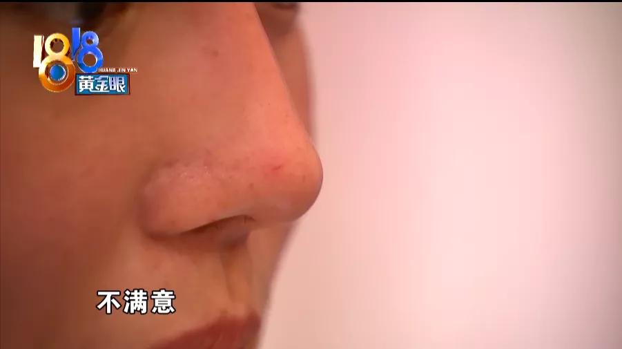 两万多做鼻子,两万做鼻子会不会太贵