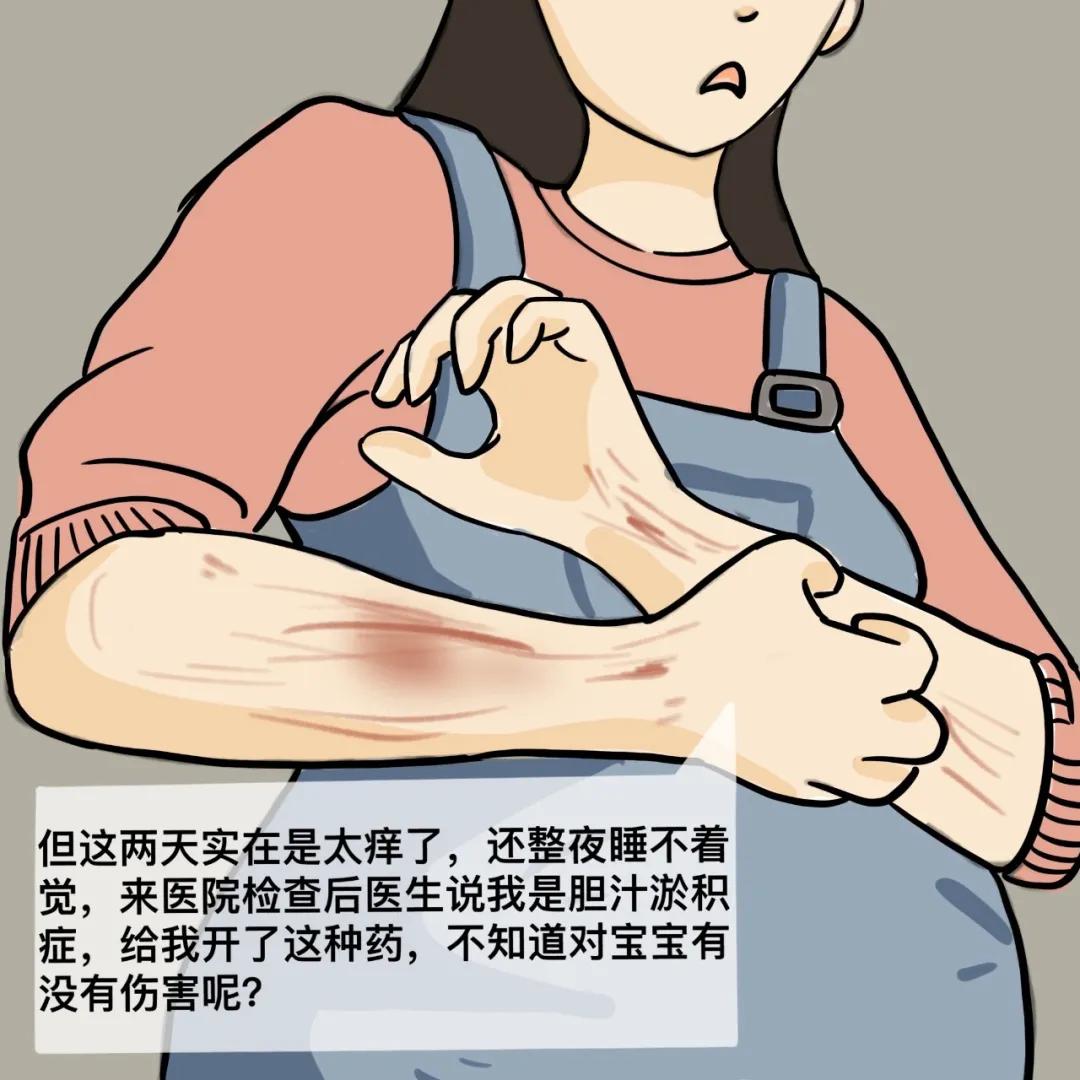 孕期吃熊去氧胆酸片会皮肤痒吗,孕期皮肤痒可以吃氯雷他定吗