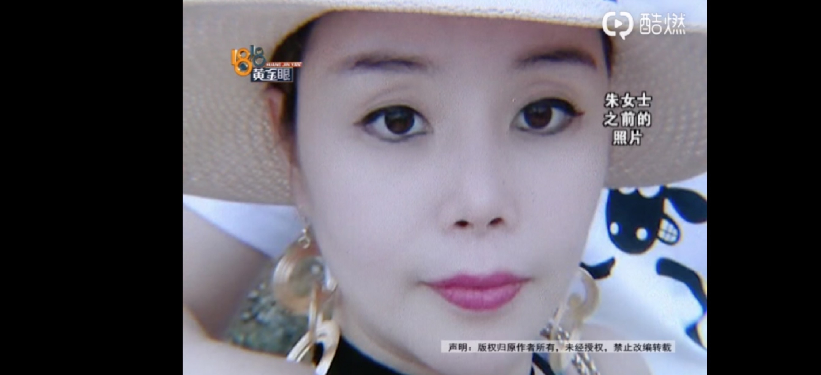 离婚的女人去整容,离婚的女人因整容失败想复婚