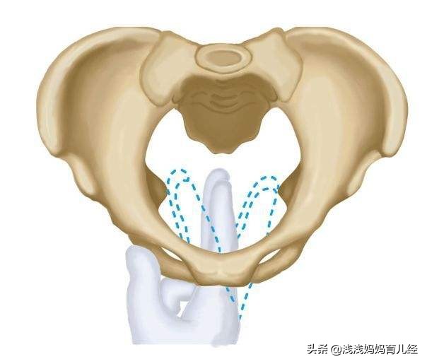 产道是顺产时胎儿的必经之路，产道分两部分，孕妈妈可了解一下