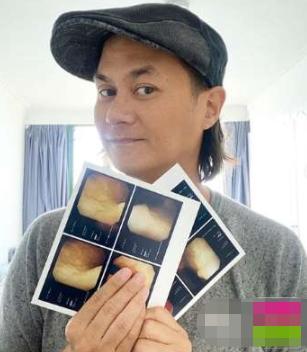 立即报平安！香港著名男星抗癌成功2年做膀胱镜检查：肿瘤没复发