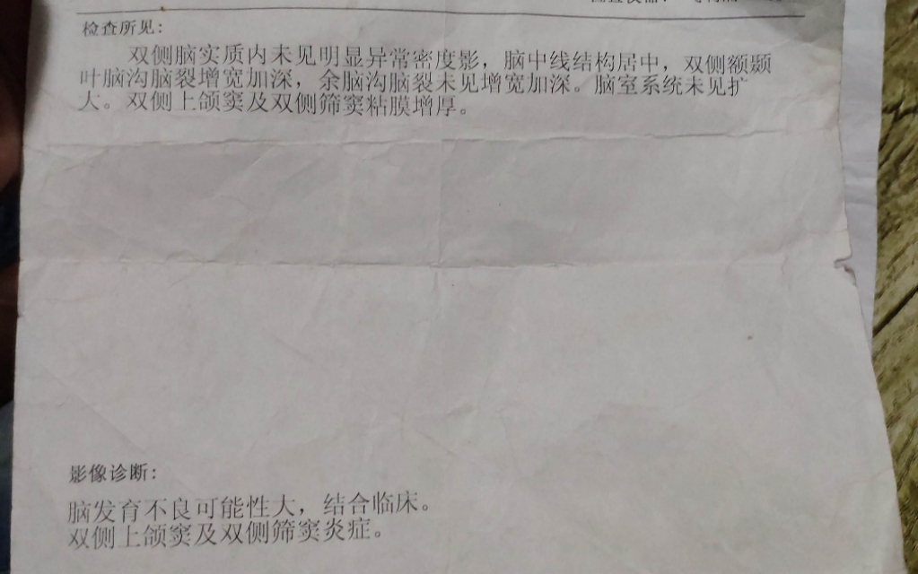 脑瘫儿眼神是什么样的,脑瘫患儿妈妈的心理