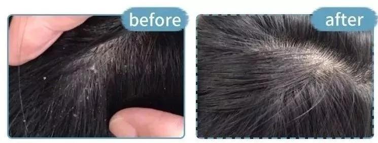 宋慧乔短发上热搜了,2020最火宋慧乔海藻卷