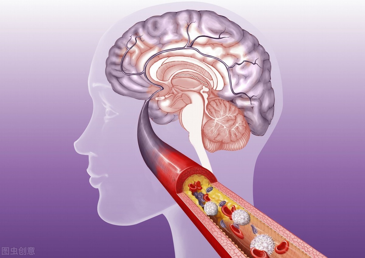 血管堵泡什么水,血管很粗摸起来硬硬的