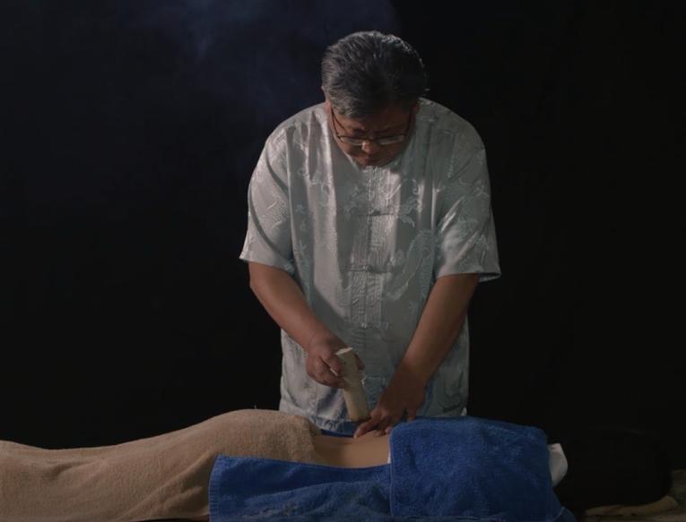 韩善明主任蕲艾灸法医案赏析——蕲艾灸法为主治疗流泪症