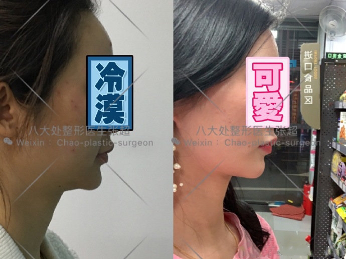 八大处整形张超,八大处张超最新视频