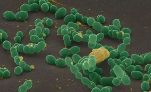 拉屎的时候怎么防止溅水,教你怎么拉粑粑不粘马桶上