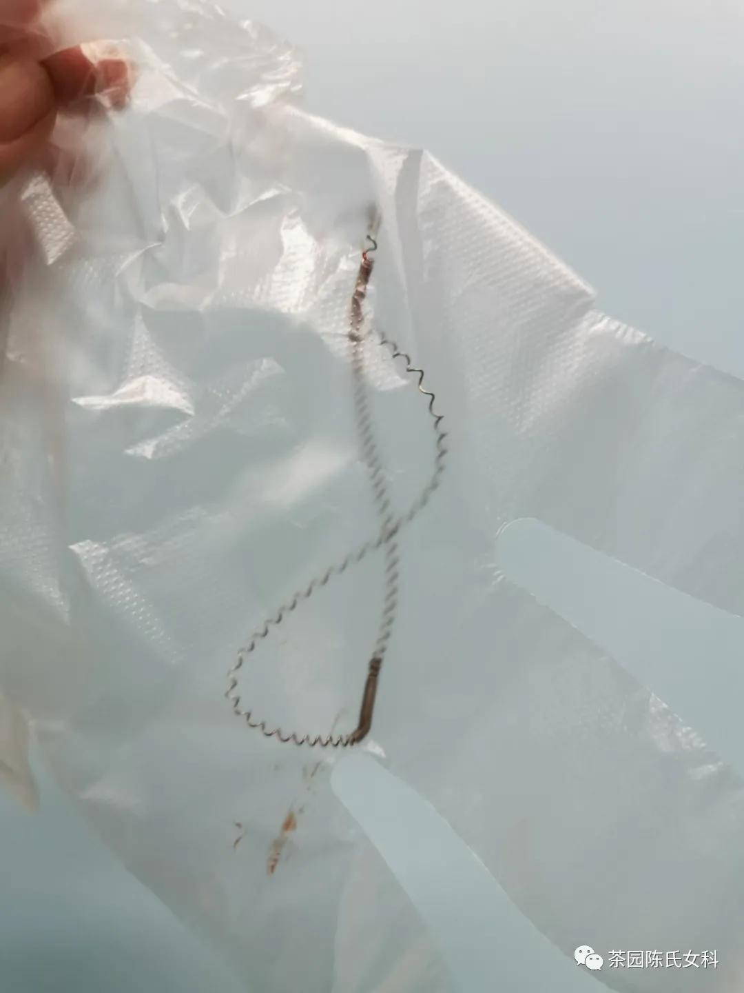 绝经后没取节育环出血是什么原因,绝经了啥时候取避孕环