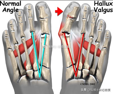 「译文分享」人体侧向子系统与单腿运动的稳定性