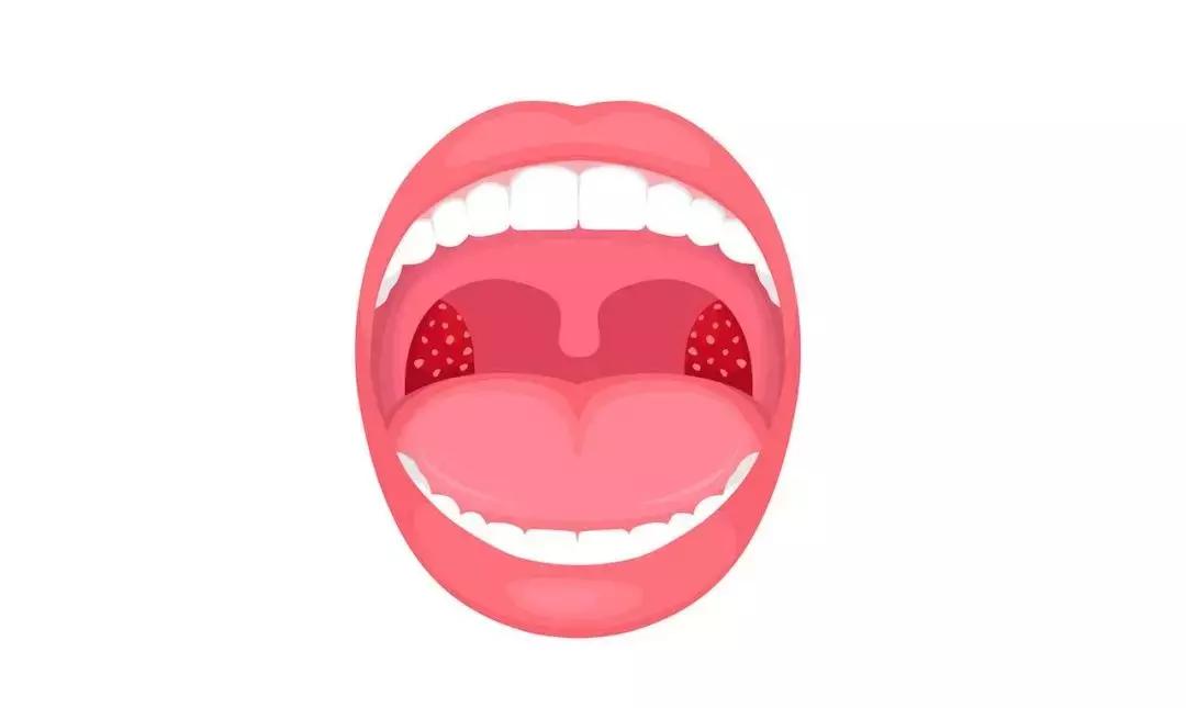 慢性扁桃体炎怎么治疗好得快,扁桃体炎的护理诊断与措施