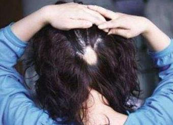 去屑止痒不伤头皮最好的洗发水,赫钻去屑控油头皮调理洗发水