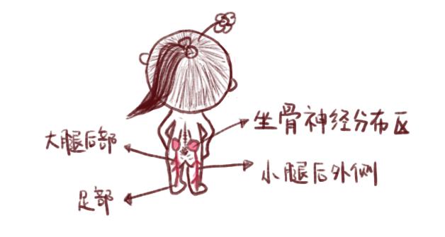 怎么缓解孕期耻骨疼和坐骨神经痛,孕期耻骨痛和坐骨神经痛怎么缓解