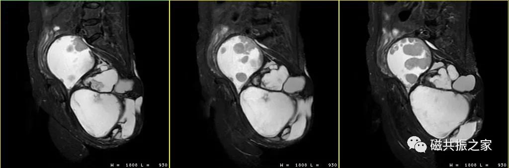 mri知识,mri讲解科普