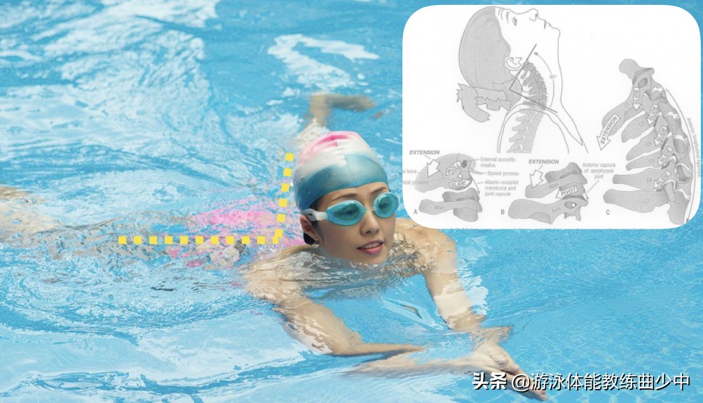 游泳治疗颈椎病？——为了健康让教练再为您补充两点