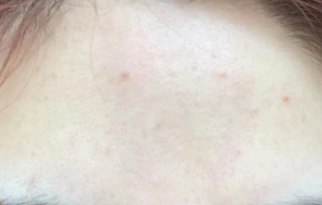 医美用的护肤品修护,医美用的化妆品