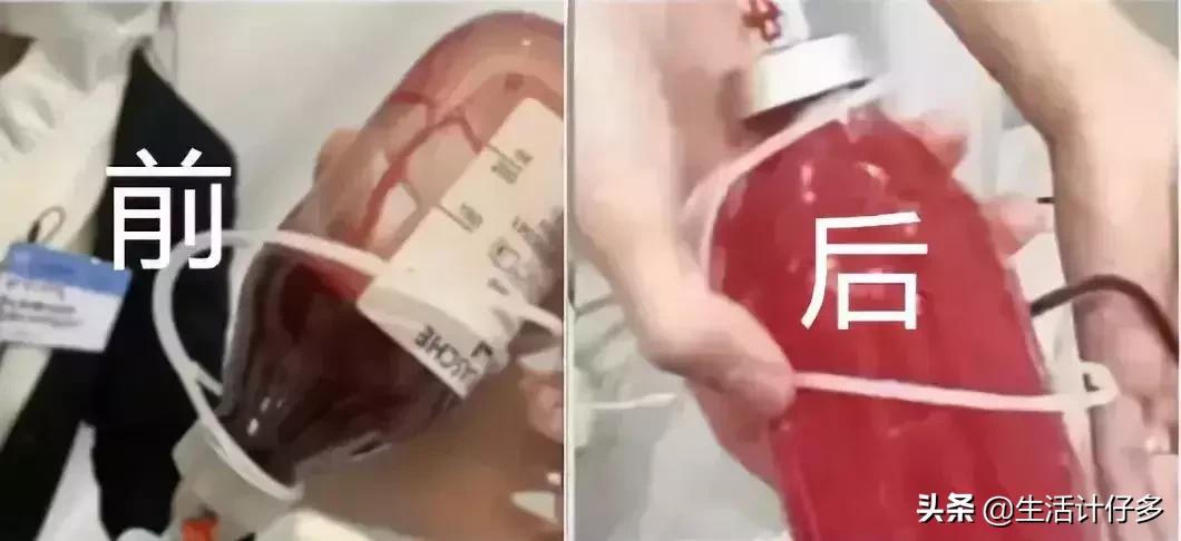 体外洗血,5万一次血液净化美容防癌