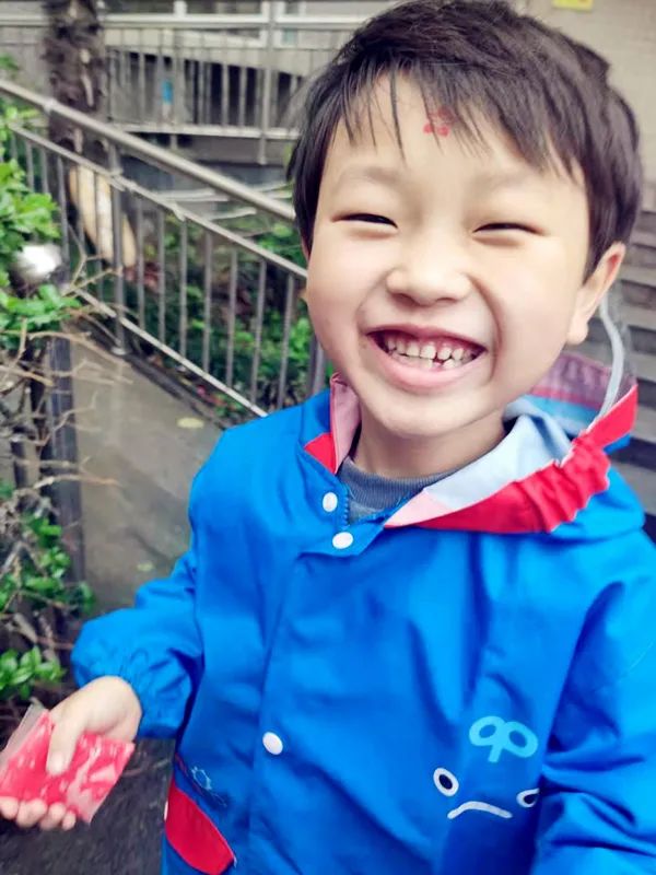 为什么乳牙好换牙就不好了,为什么现在的孩子换的门牙特别大