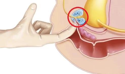 骑车上下班护心脏！但超过这个时长前列腺会遭殃