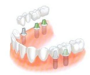 牙科的良心忠告,牙医的良心忠告牙齿矫正